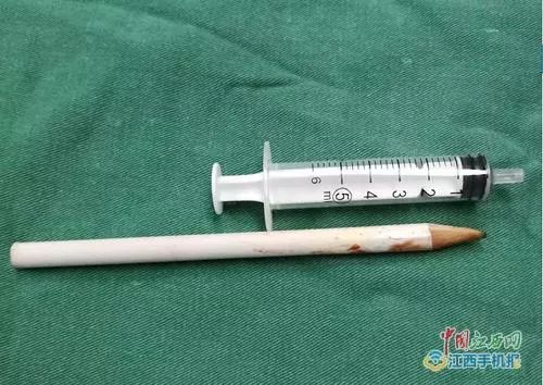 6岁男童意外跌落致脾脏破,甘肃岁男孩骑车摔倒扎破眼球