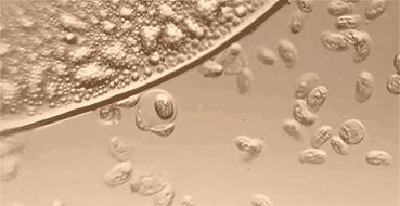 妇科疾病与内裤有关吗,女性经常有妇科病穿牛仔裤好吗