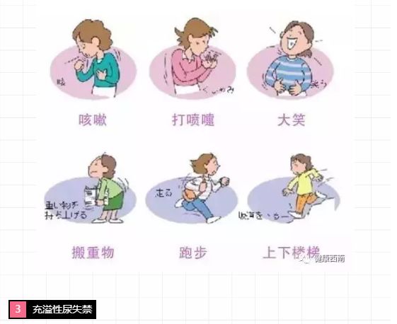 女性尿道口生理科普知识大全,科普女性如厕知识