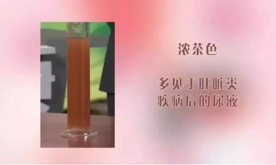 有一种尿的颜色或是癌症信号，赶紧检查一下你尿液的颜色！