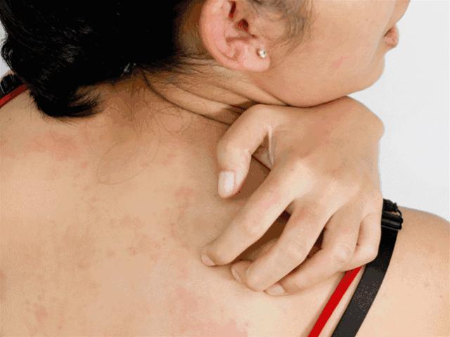 皮肤清洁出黑色的东西,皮肤挤出白色膏状很臭怎么办