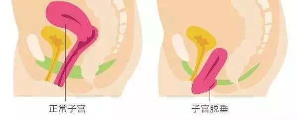 ella谈产后恢复,ella回应产后后遗症