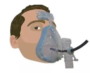 支气管镜热消融术治疗慢阻肺,西京医院支气管镜