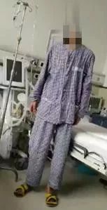 支气管镜热消融术治疗慢阻肺,西京医院支气管镜