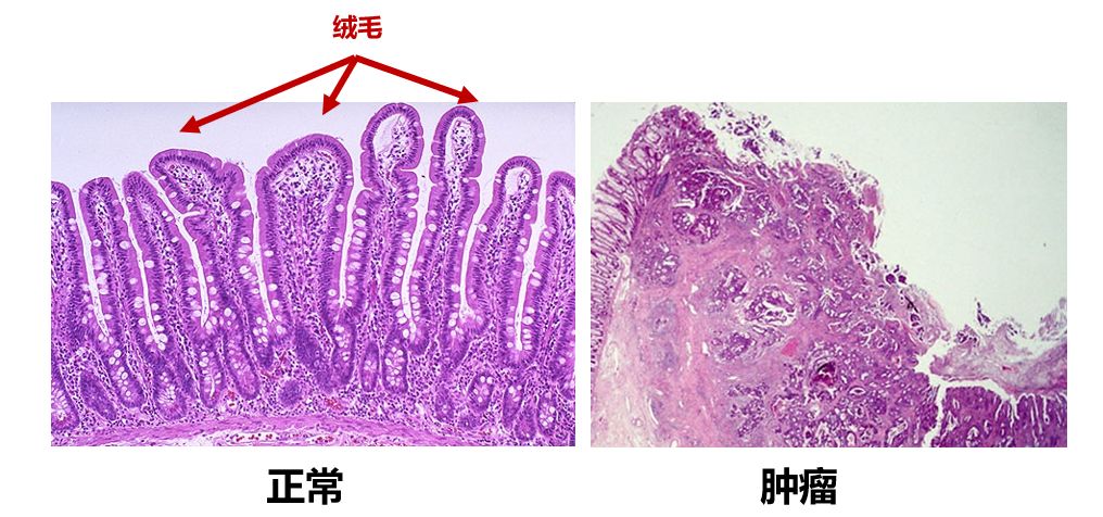我们的城市病了怎么办,我们的城市病了英文视频