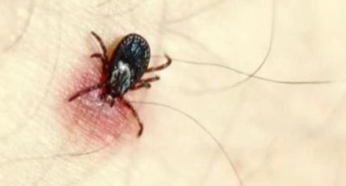 警惕这小虫,六安已有人因它致死!当下高发期!