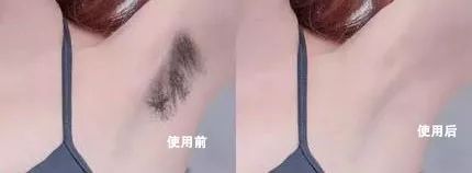 脱毛没那么复杂来这里三步搞定,这才是夏天脱毛的正确打开方式