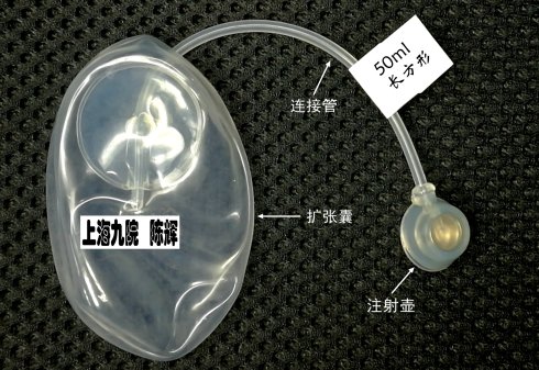 点黑痣后用什么修复最好,黑色素痣扩张术是什么原理