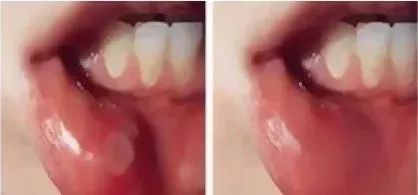 团购|俄罗斯亮白牙膏组合，轻松瓦解多年牙垢，清新口气告别黄牙