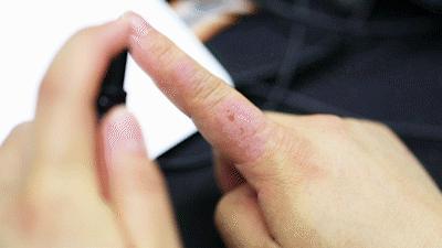 蚊虫叮咬脚气怎么办,超好用的止痒消肿的药膏蚊虫叮咬