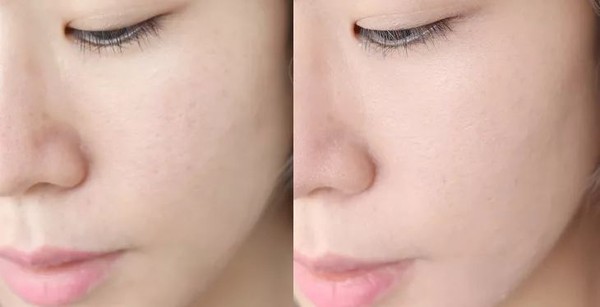 气垫遮瑕持久不脱定妆第一名,口碑最好十大气垫适合干皮