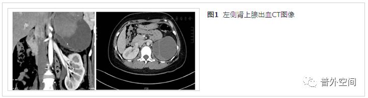 肾上腺出血病因及治疗,肾上腺出血什么意思