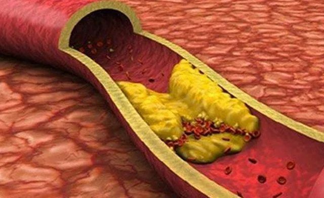 颈椎病脖子咔咔响怎么治,脖子一动就咔咔响头晕是什么原因