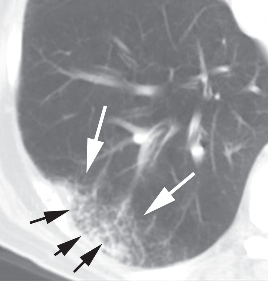 认识肺部的目的,认识呼吸器官知识点