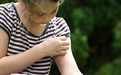 小儿被蚊子咬了怎么消肿止痒最快,被蚊子叮咬后用盐能快速止痒