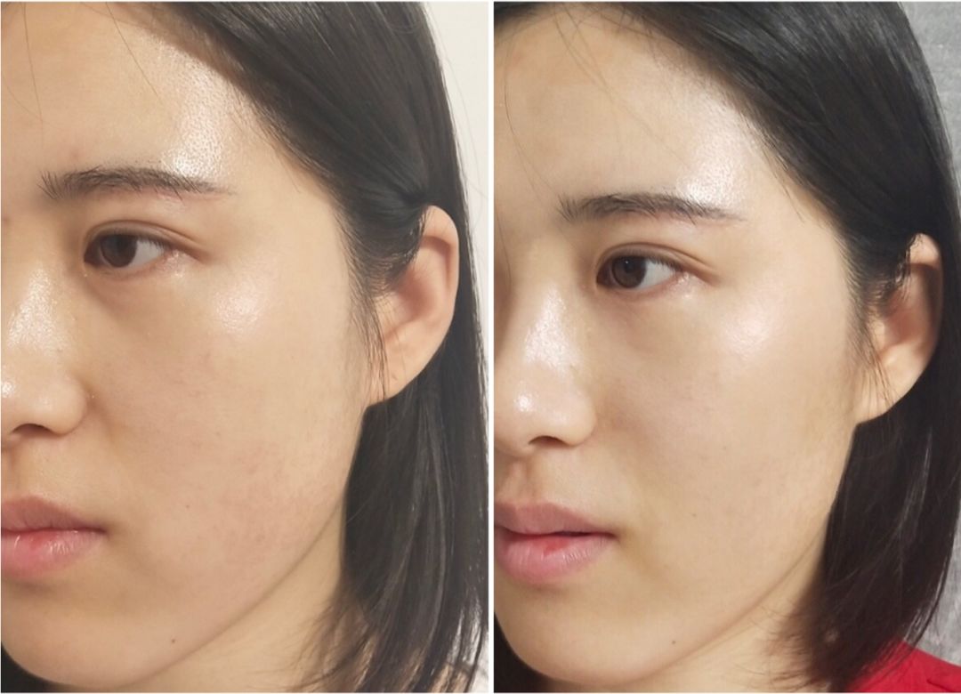 端正清秀新思路：学她们做「氧气美人」美足30年