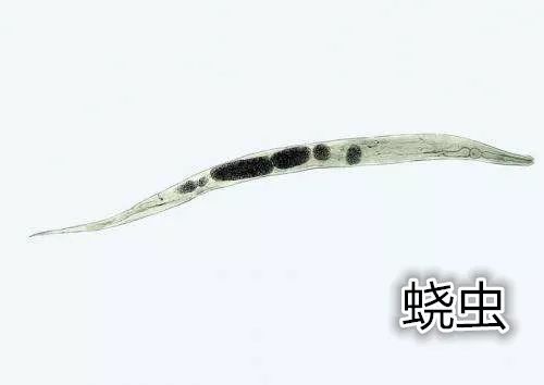 可怕！杭州4岁宝宝老是挠屁屁，大半夜还爬出白色小虫