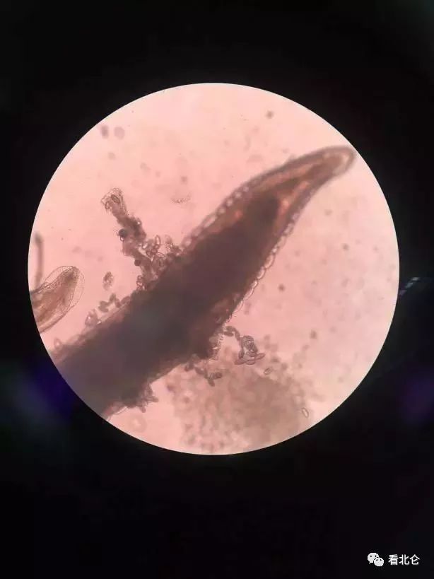 宝宝尿裤穿久屁股痒怎么办,小宝屁股上穿纸尿裤痒怎么办