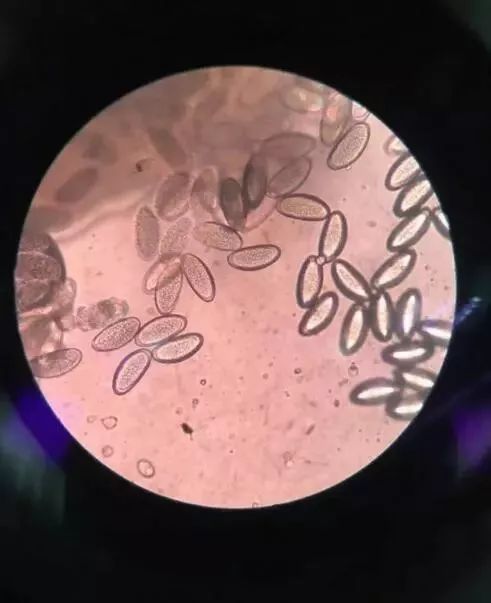 4岁女童屁屁痒，妈妈检查后吓坏了！一粒粒竟还会动...