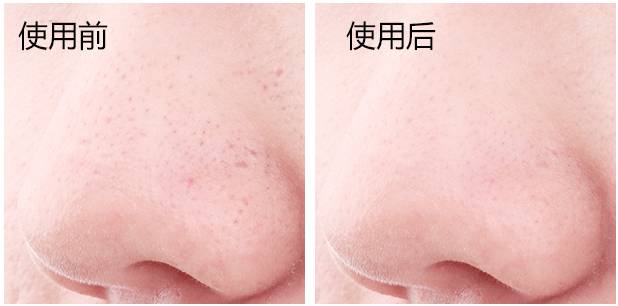 人鱼公主嫌弃婆家穷,人鱼公主下嫁却遭婆婆嫌弃