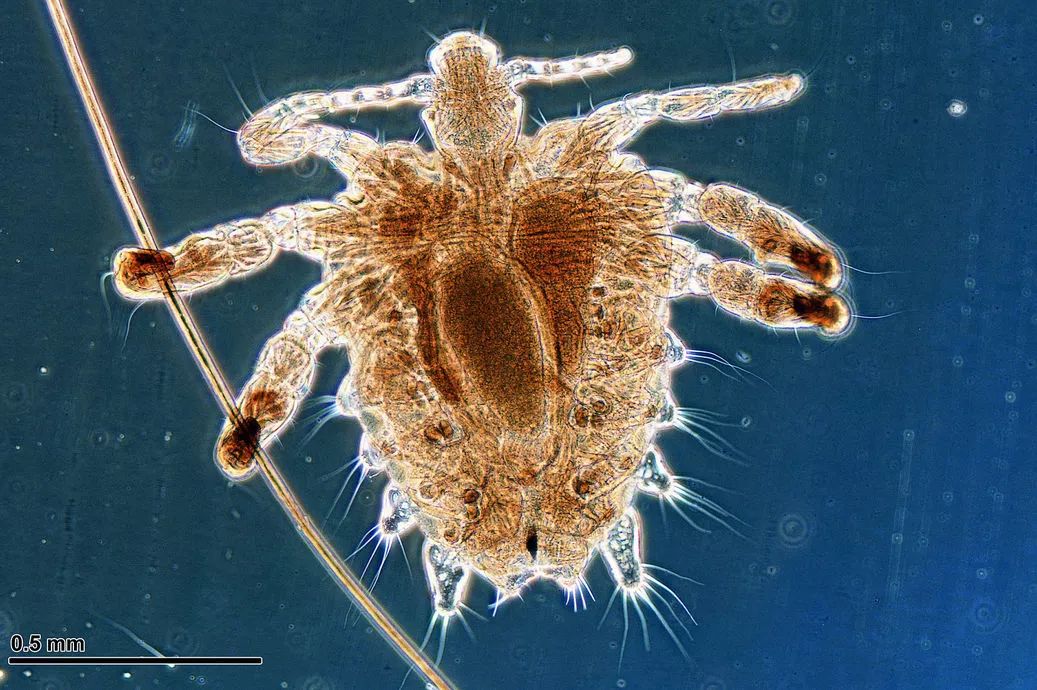 一些吸血的昆虫蜱虫,好多小虫子吸血