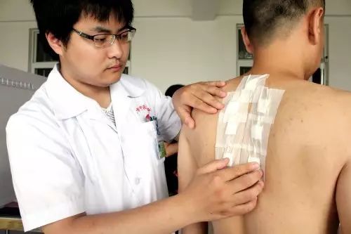 “三伏贴”正式开贴，到阜阳这些地方可体验“冬病夏治”