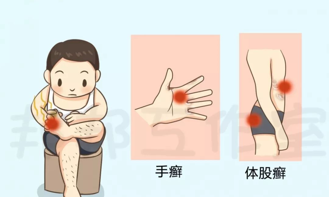 天一热脚气又反复发作,天一热脚就肿是怎么回事