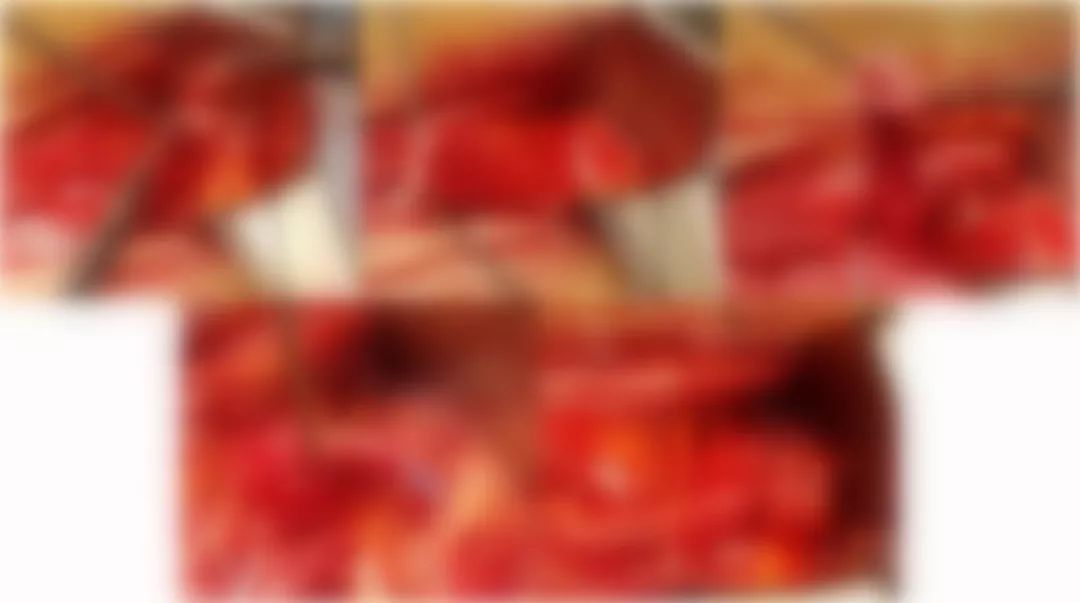 一个肾脏两条输尿管？这类肾移植该怎么做？|手术图解