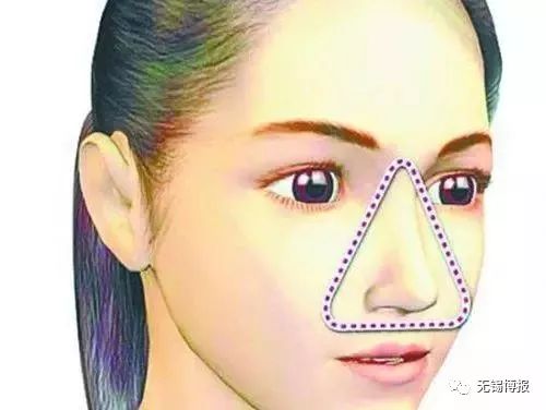 鼻子上长痘痘可以挤掉吗,鼻子长痘的快速消法