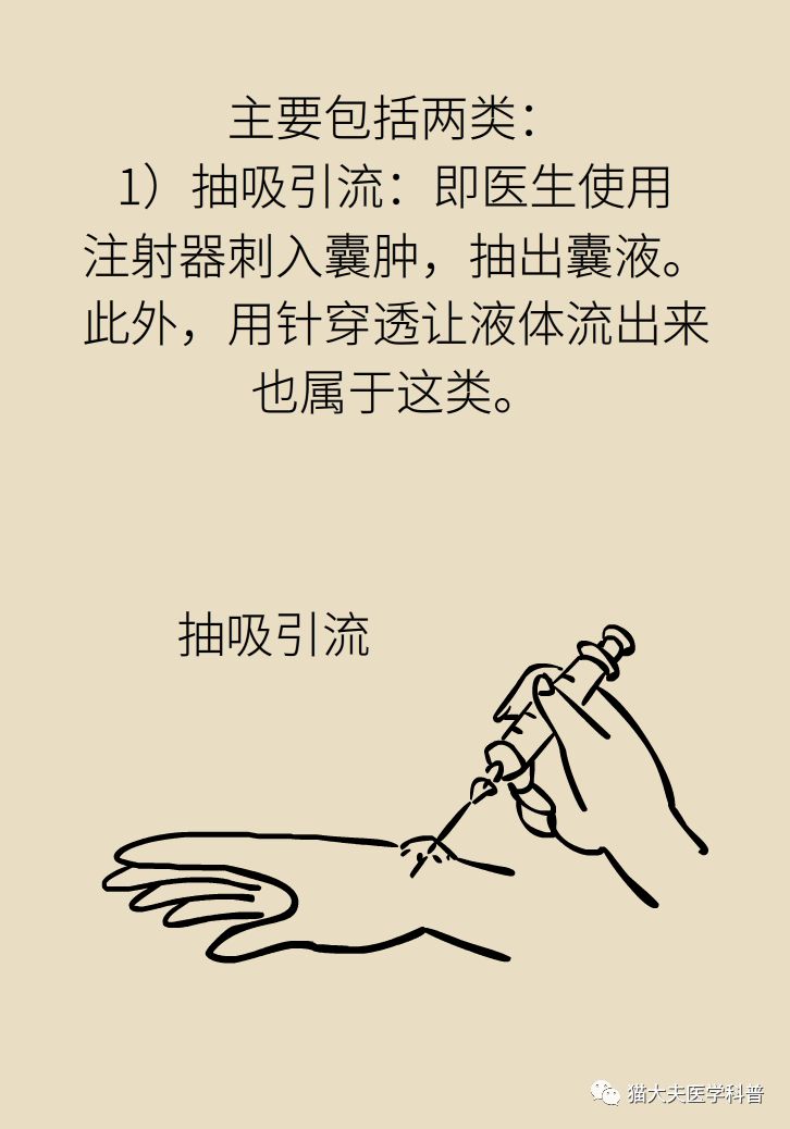 手腕长腱鞘囊肿,小孩手腕起了一个腱鞘囊肿要紧吗