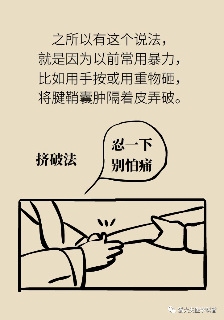 手腕长腱鞘囊肿,小孩手腕起了一个腱鞘囊肿要紧吗