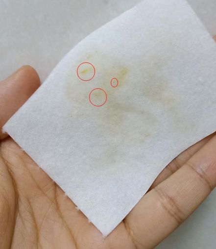 草莓鼻去黑头好物推荐使用,草莓鼻去黑头导出液