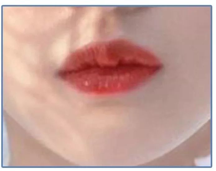 泫雅丰唇后颜值下跌?!但大家都爱这样的“香肠嘴”啊