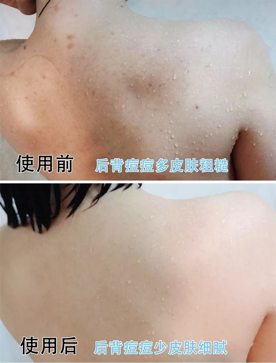 洗澡搓背神器不伤肤无痛,洗澡搓背神器去死皮深层清洁