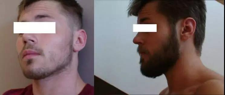 4岁孩子长小胡须,4岁小男孩长小胡须