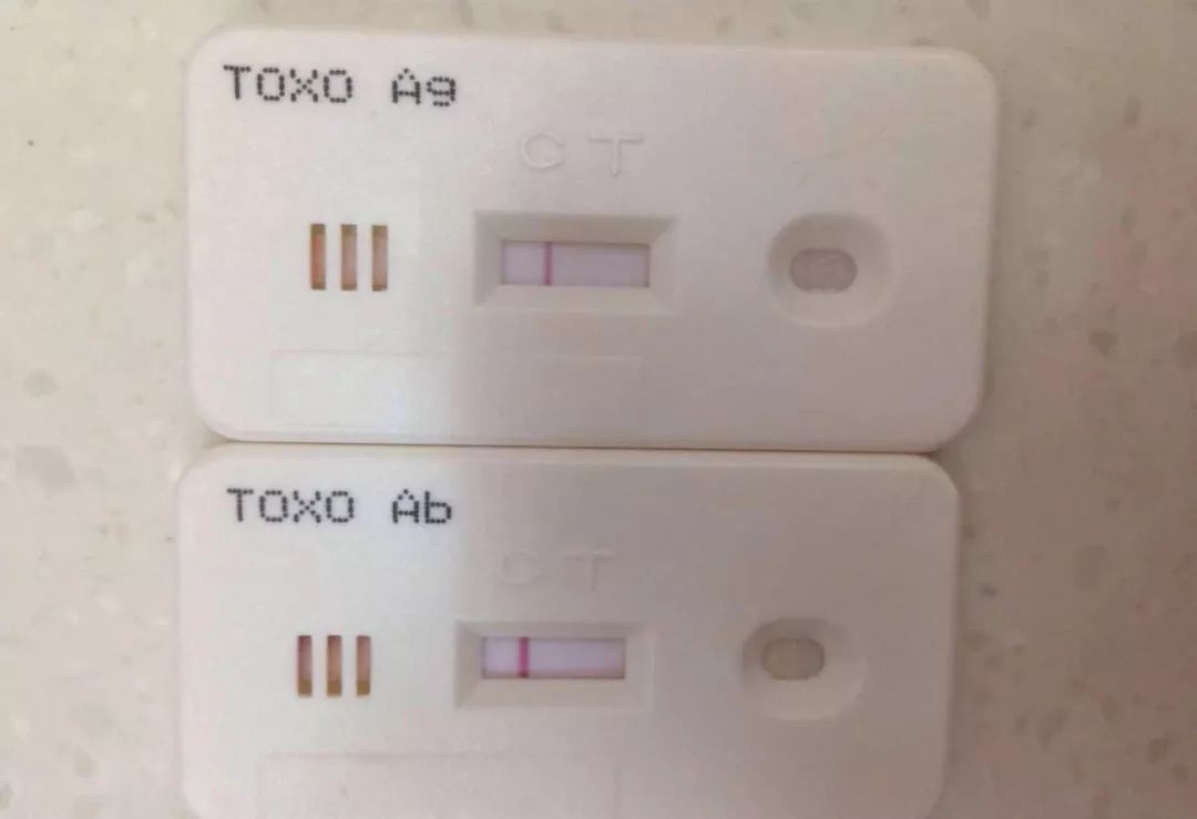 准备怀孕的人可以养狗养猫吗,怀孕家里养猫对胎儿有影响吗