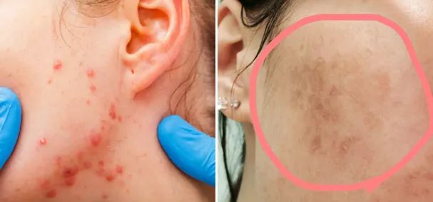 告别“大腹婆”，立变“小腰精”！穿上它，躺着拥有平坦小腹