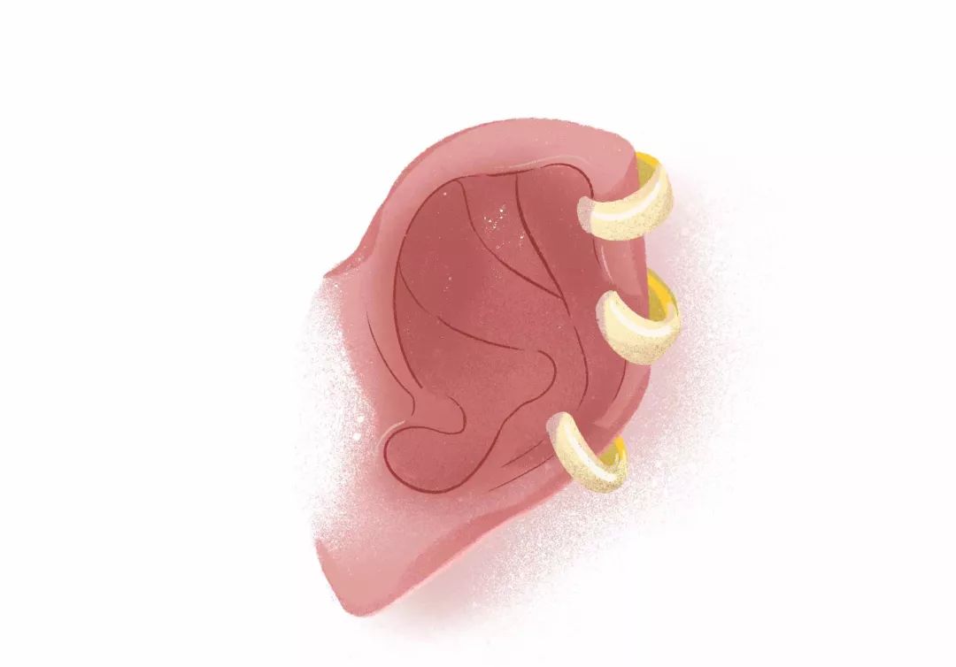 打耳洞容易出事情吗,打耳洞可能会聋吗