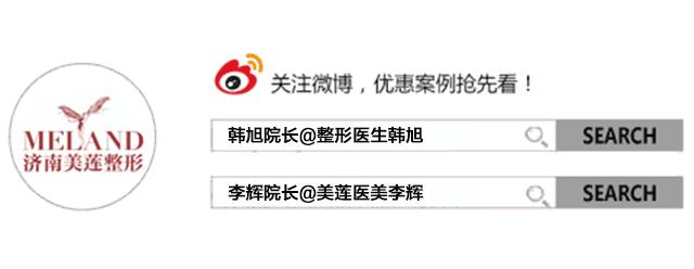 女人竟然长了胡子,女孩子长胡子用脱毛膏