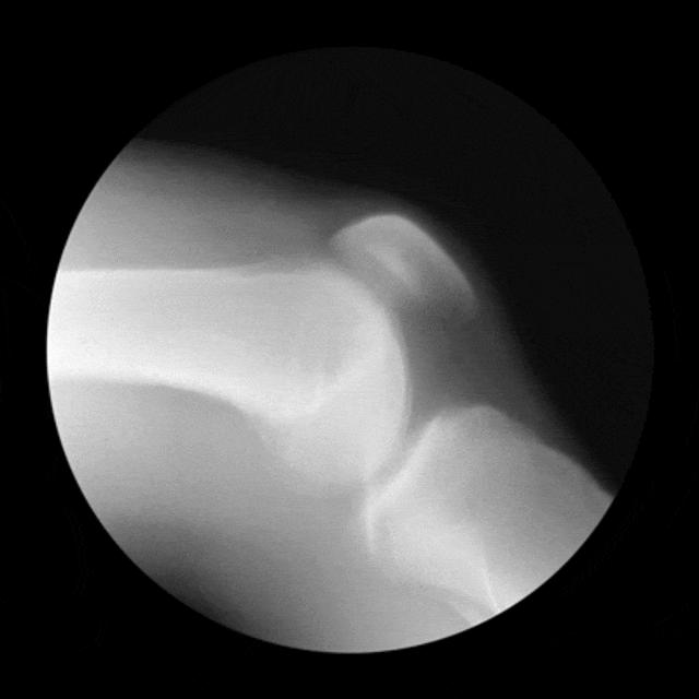 膝盖各部位损伤如何判断,膝盖周围疼痛的鉴别诊断