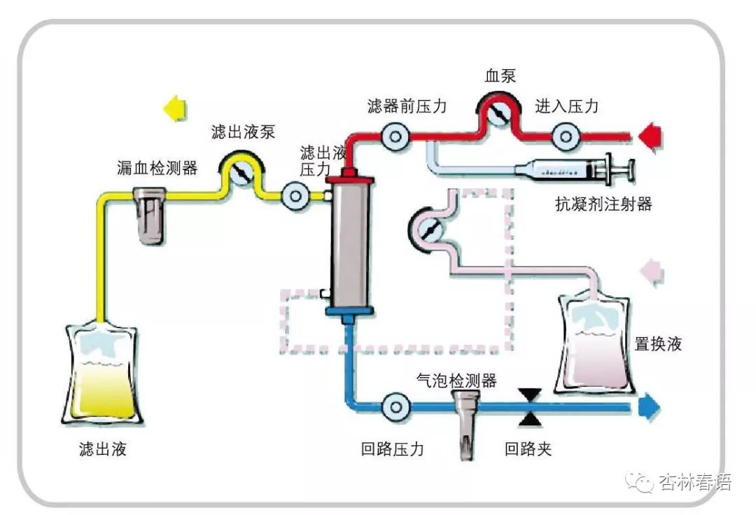 「东院之窗」我院东院区“连续性血液净化设备”投入使用