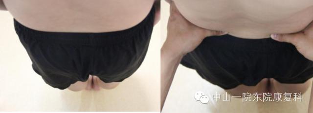 康复治疗技术人体解剖学,12条筋膜链解析及治疗手法