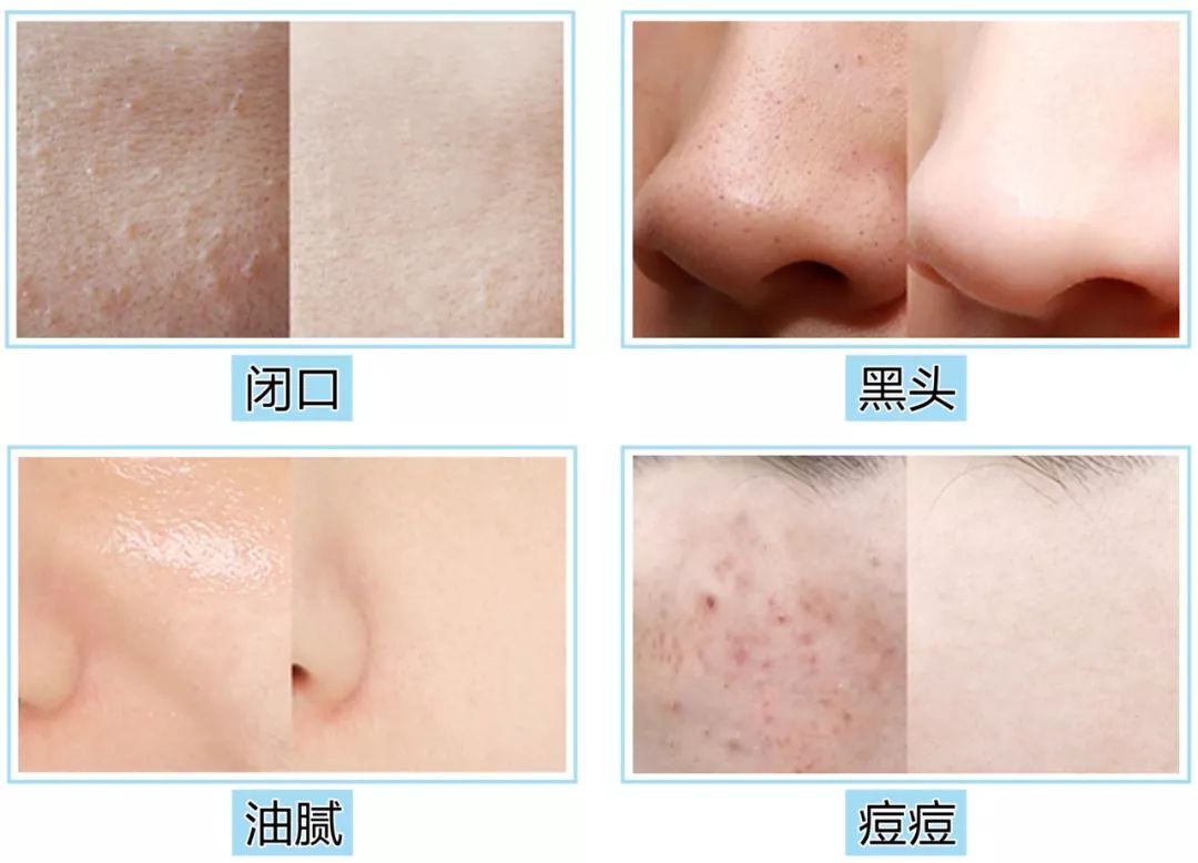 皮肤科医生护肤简单,皮肤科医生各种药膏的护肤作用