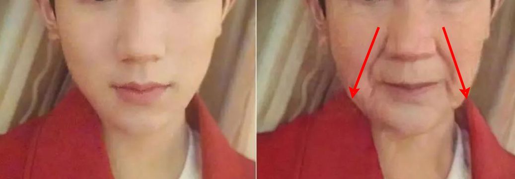 法令纹眼纹一个都逃不掉,法令纹和眼纹怎么才能有效改善