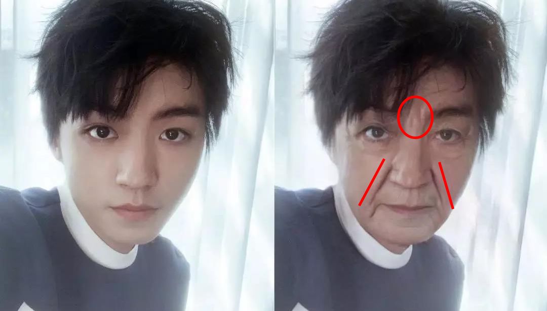 法令纹又黑又长,法令纹又深又长好吗