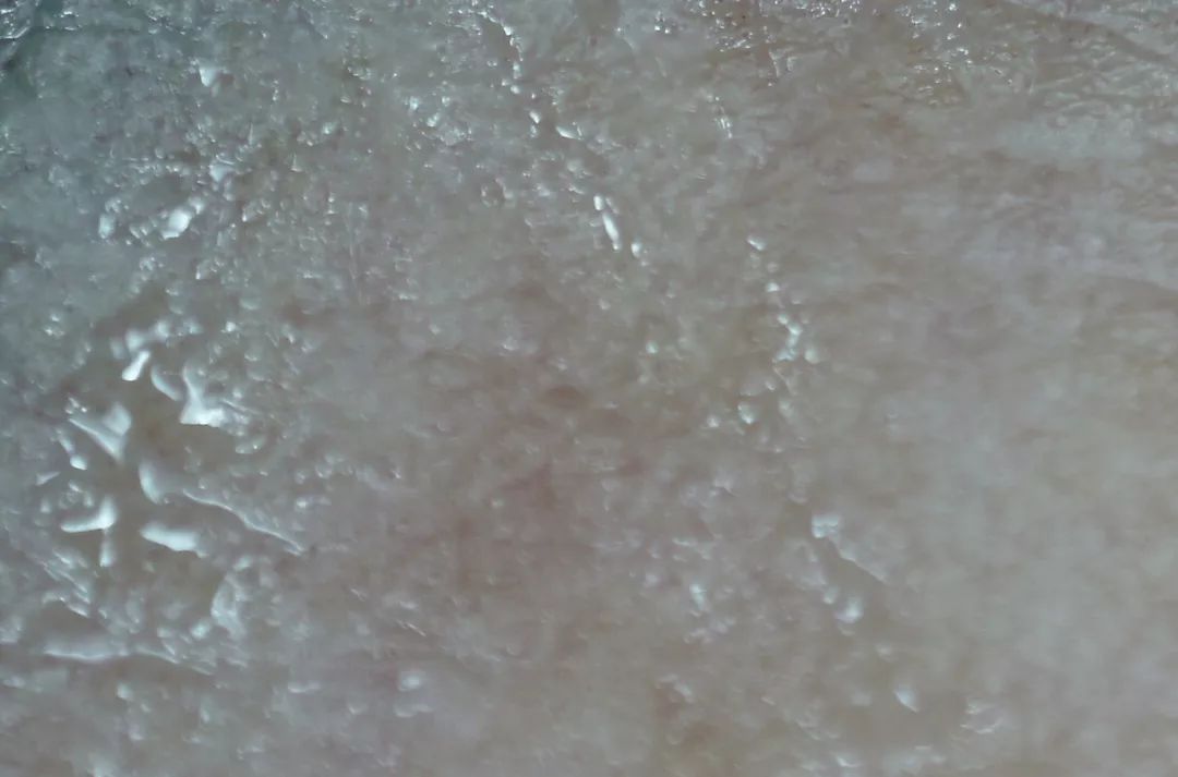 眉间纹和法令纹除皱针能去掉吗,嘴角纹法令纹抬头纹国货推荐