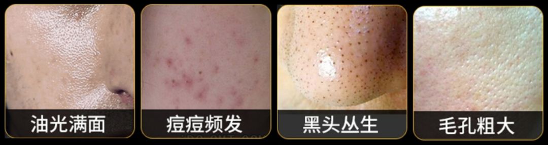 娆ц幈闆呮帶娌圭偔鐖芥礂闈㈠ザ鐢峰コ閫氱敤,娆ц幈闆呯敺澹礂闈㈠ザ鎺ф补娓呯埥娴嬭瘎