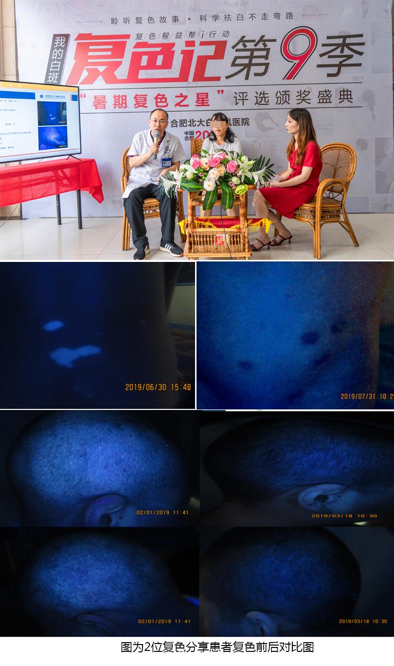 复色帮益帮i行动·我的白斑复色记第9季在合肥北大完美落幕