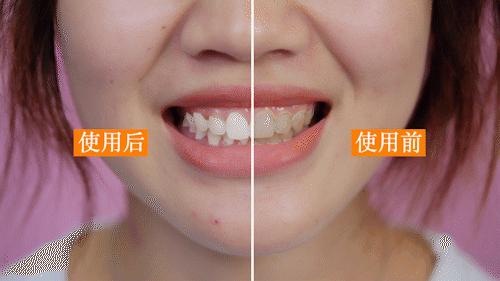 牙龈上火、红肿，还口臭？香港人用了91年的中药牙膏，消炎抑菌，让你刷出一口健康好牙