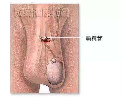避孕药具基本知识内容,免费领取的避孕药具好用吗